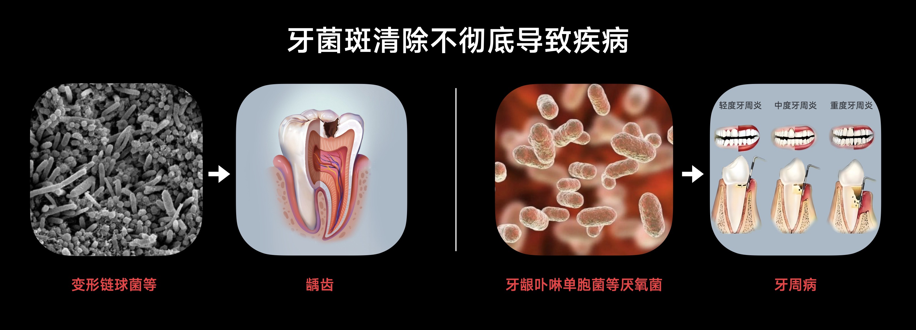 有氧小气泡 柔净不伤牙 欧可林AirPump A10氧气啵啵冲牙器新品品鉴会举行